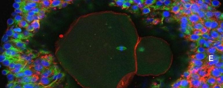 Исследователи вырастили полностью зрелые человеческие яйцеклетки в лаборатории